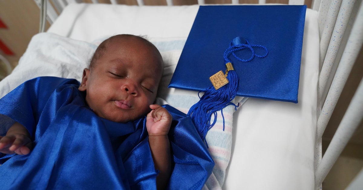 Toddler spends 170 days at Broward Health and fitness, now completely ready to go residence