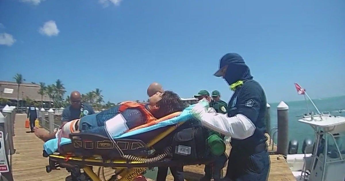 Person bitten by bull shark in Keys talks about ordeal