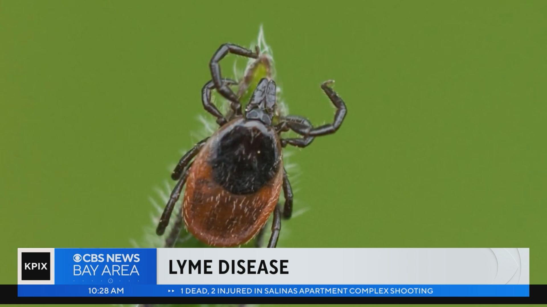 Tick season brings threat of Lyme disease
