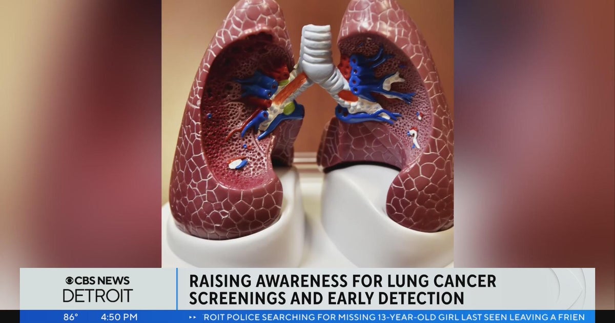 Raising Awareness For Lung Cancer Screenings Early Detection Cbs Detroit Raising Awareness For Lung Cancer Screenings Early Detection Cbs Detroit