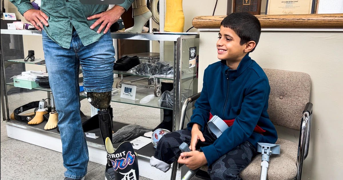 Hope and Healing: Gaza boy brought to Detroit for prosthetic after surviving bombing in Palestine