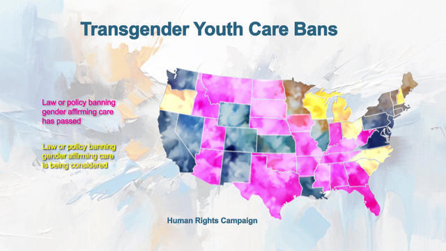 transgender-youth-care-bans-1920-2059771-640x360.jpg 