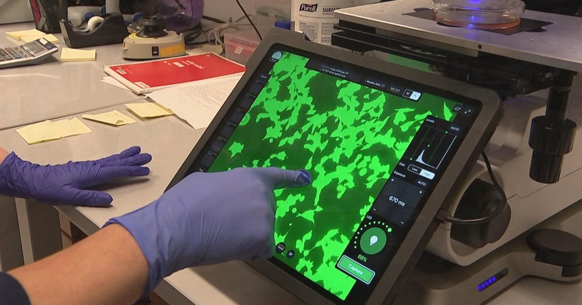 CHOP doctor making strides in finding cure for neuroblastoma in