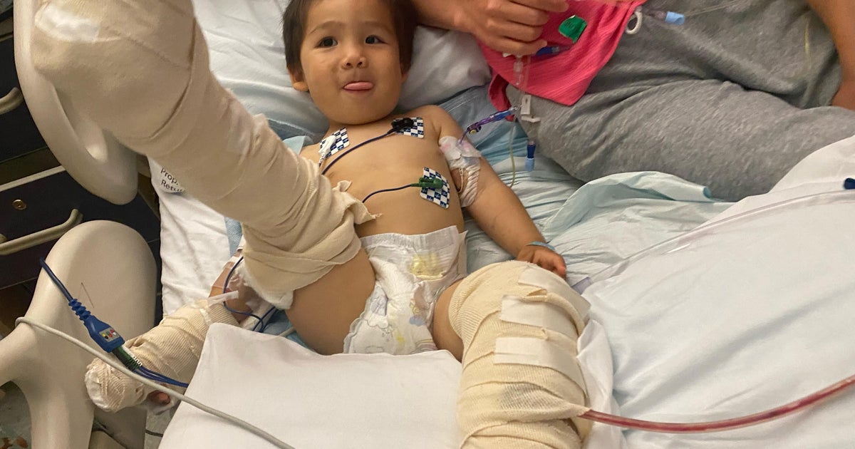 Toddler recovering after getting hit by truck in Concord; Family meets ...