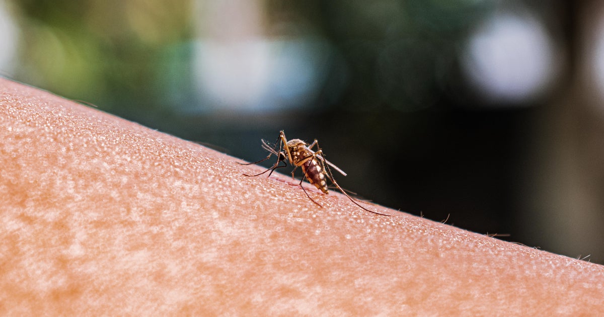 What is malaria What to know as Florida Texas see first locally acquired infections in 20 years  CBS News What is malaria What to know as Florida Texas see first locally acquired infections in 20 years  CBS News
