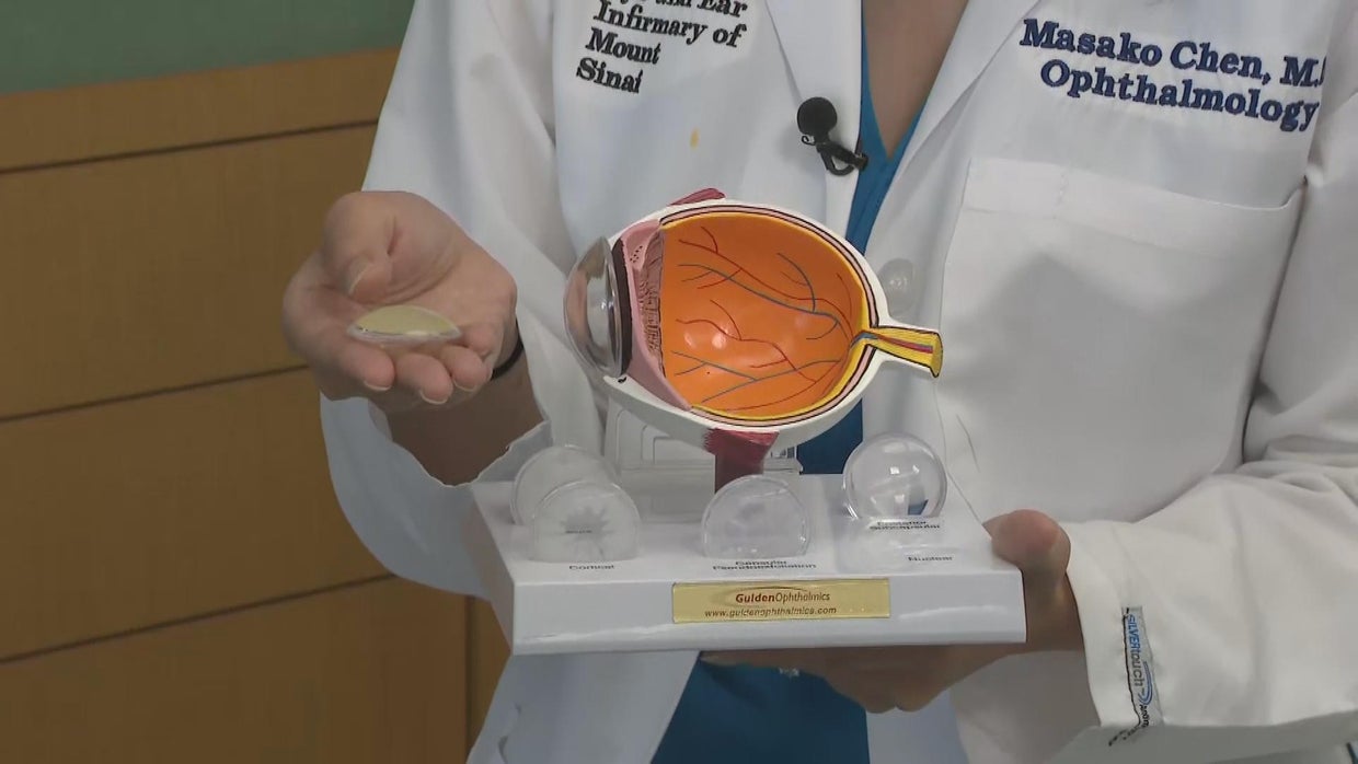 Making way for new, improved lens with ultrasonic emulsification for ...