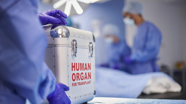 organ transplant surgery 