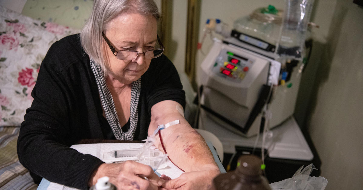 "It was a bloodbath": Rare dialysis complication can kill patients in minutes — and more could be done to stop it