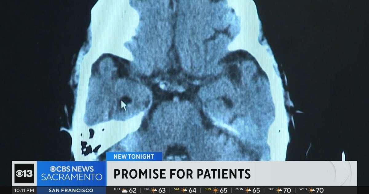 New drug that slows Alzheimer&rsquo;s gets full FDA approval