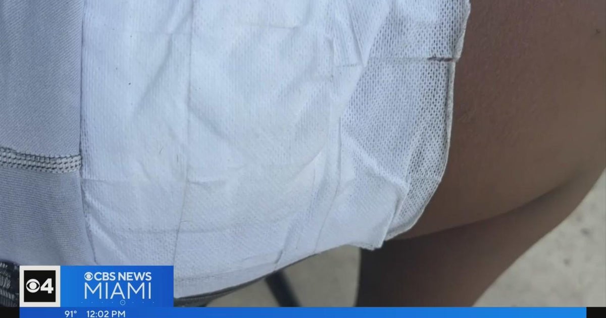 Teenager struck in leg by stray bullet in Fort Lauderdale shooting
