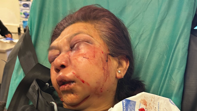 elderly-woman-attacked2.png 