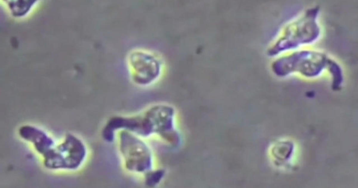 Brain-eating amoeba death in Georgia
