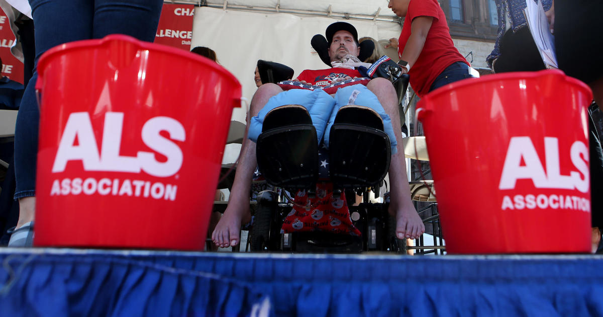 What is ALS?  Experts explain symptoms to watch out for, causes, and treatments