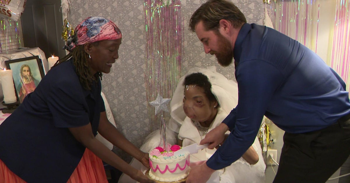 Woman who experienced 16-pound tumor eradicated from deal with receives married Woman who experienced 16-pound tumor eradicated from deal with receives married