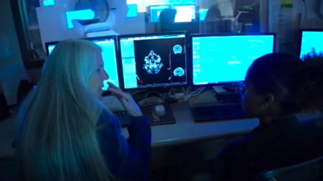 young people looking at brain scan 
