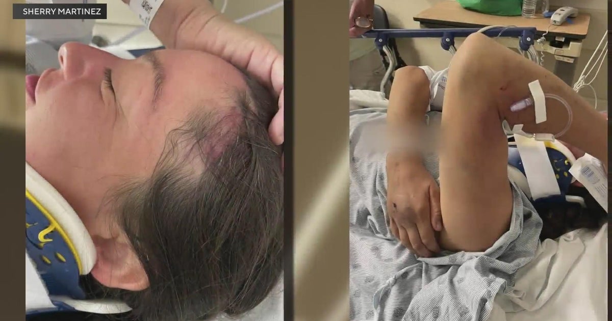 Community leader speaks from hospital bed after driver ran her over in Sacramento