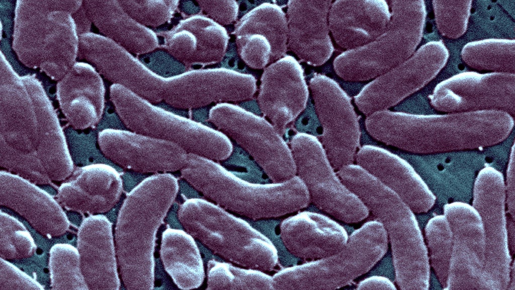 Rare, flesh-eating bacteria found in Florida including Miami-Dade, state health officials say