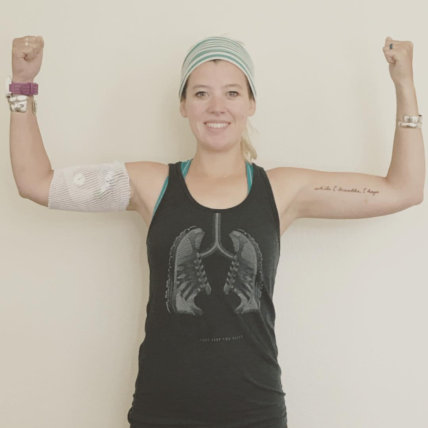 Sabrina Walker, a cystic fibrosis patient, poses against a blank wall while wearing a black T-shirt and a green-and-white striped head wrap. She has a bandage on her right arm. 