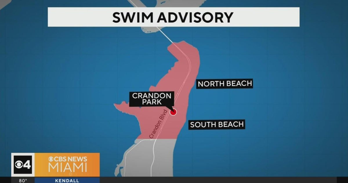 Swim advisory posted fro Crandon Park