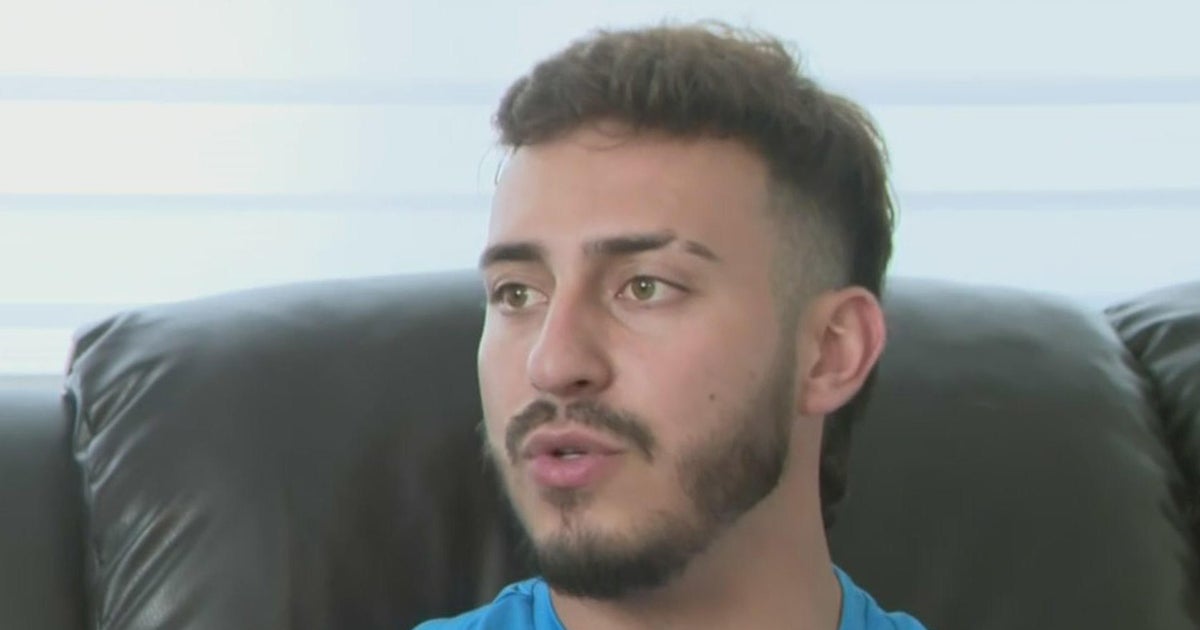 Miami Gardens strike and run target believes he discovered the car that struck him, CBS News Miami exceptional