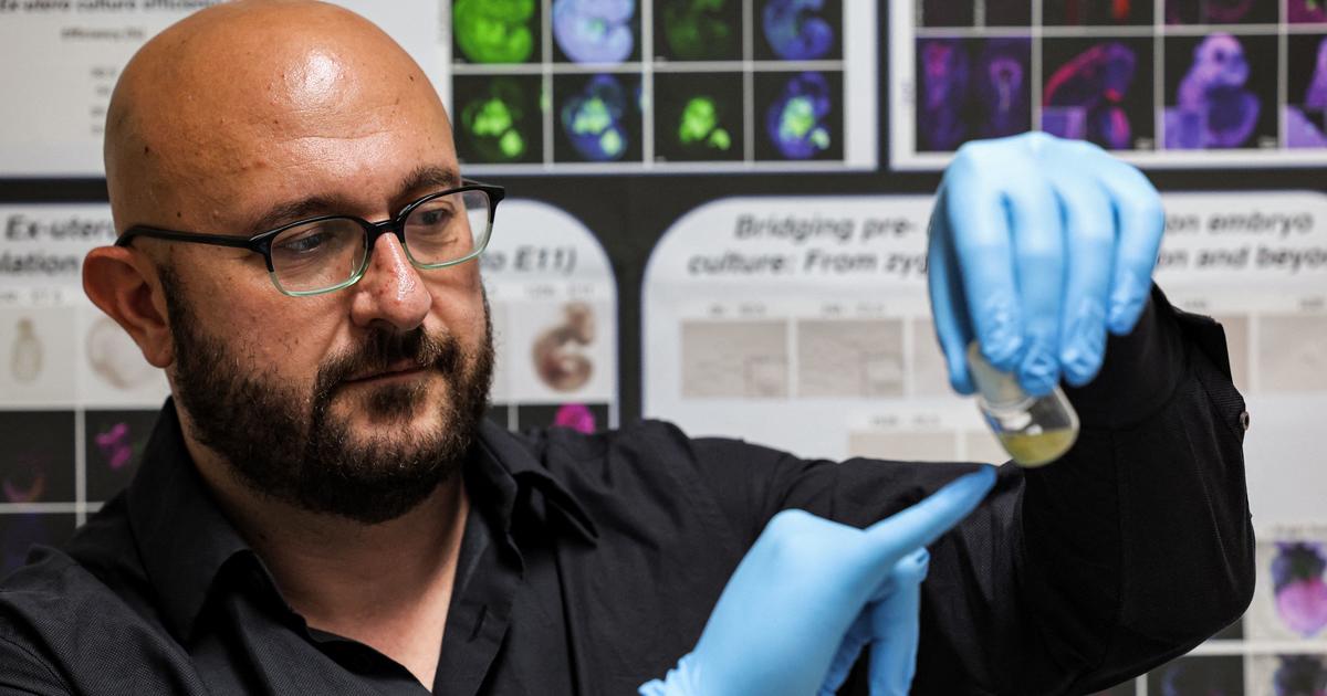 Human "embryo-like structures" developed in Israeli lab