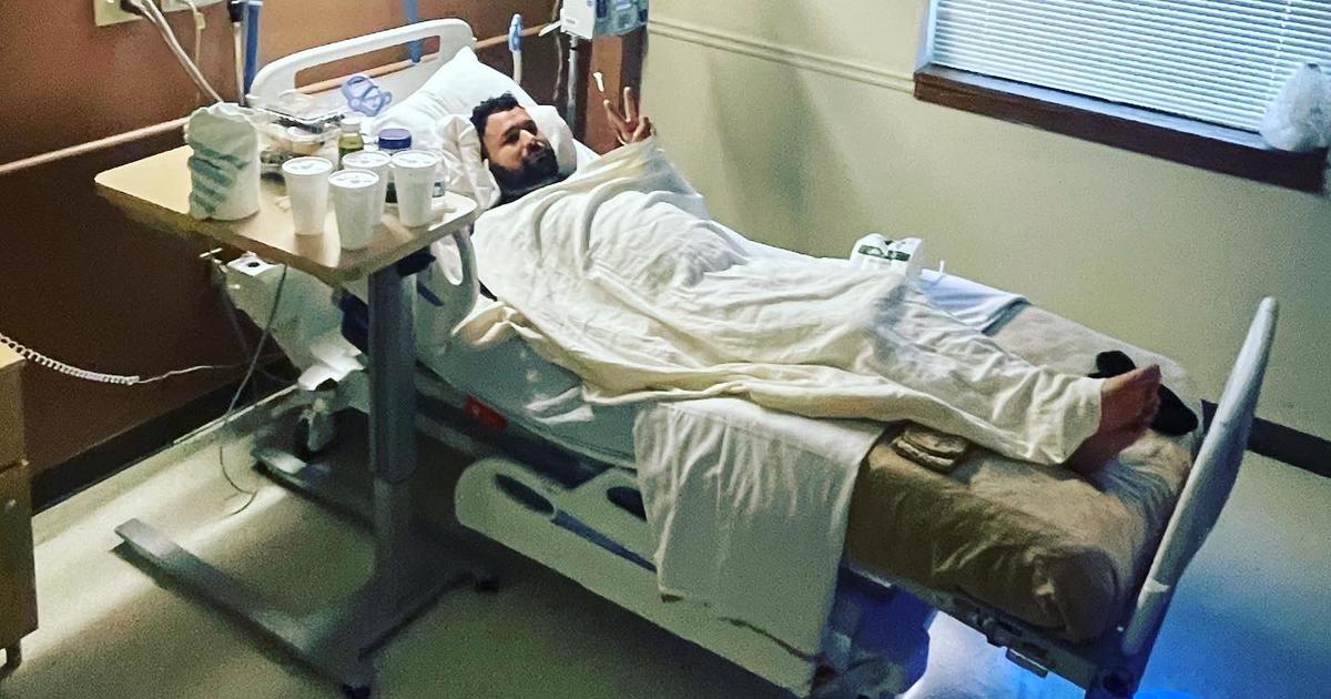 Мъж от Джорджия почти загуби крака си от ухапване от кафяв паяк отшелник. Какво трябва да знаете за симптомите, които могат да причинят „непоносима болка“.