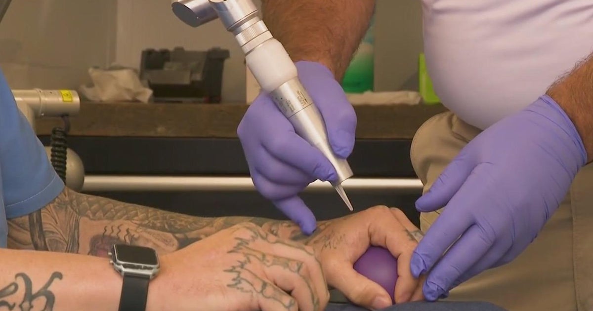 Erasing the past, tattoo removal program giving San Quentin inmates a second chance - Vimarsana News