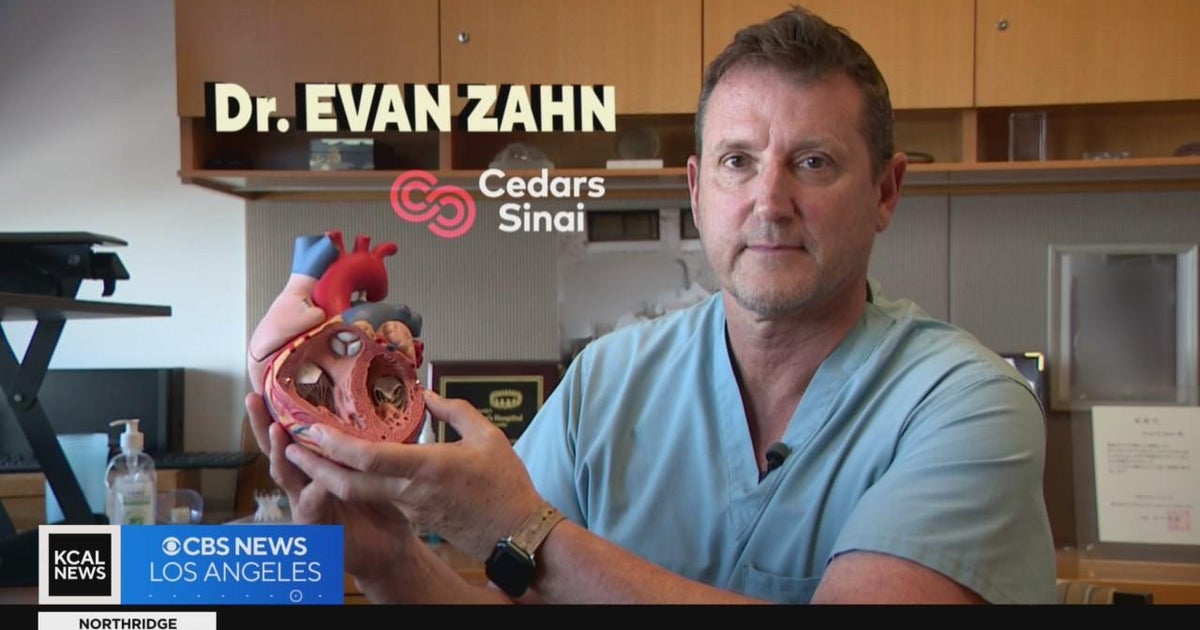 Meet a congenital cardiologist, Dr. Evan Zahn STEAM CBS Los Angeles