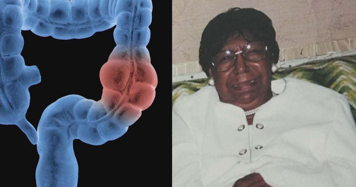 Colon cancer disproportionately impacts Black Americans, but new campaign wants to close the gap Colon cancer disproportionately impacts Black Americans, but new campaign wants to close the gap