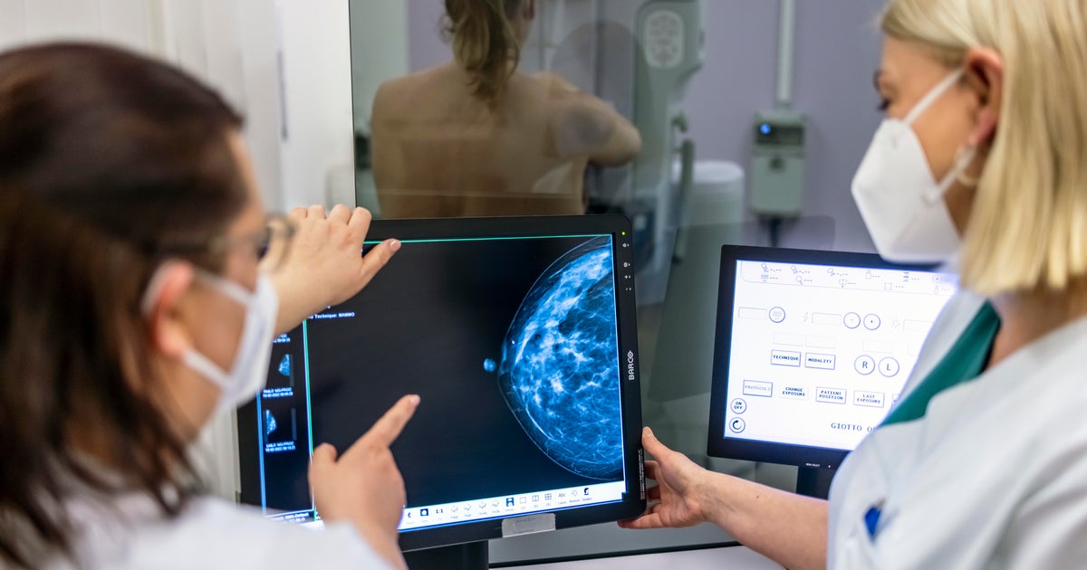 Scientists finding out hyperlink between breast cancer and alcohol Scientists finding out hyperlink between breast cancer and alcohol