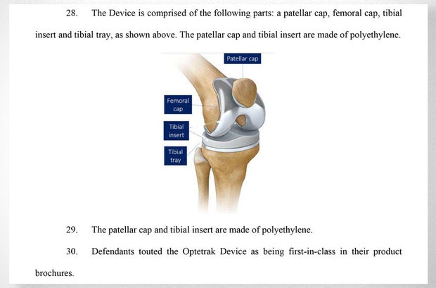 knee-diagram.jpg