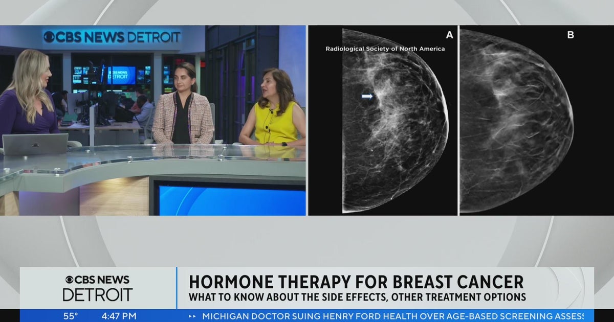 What to know about hormone therapy for breast cancer CBS Detroit