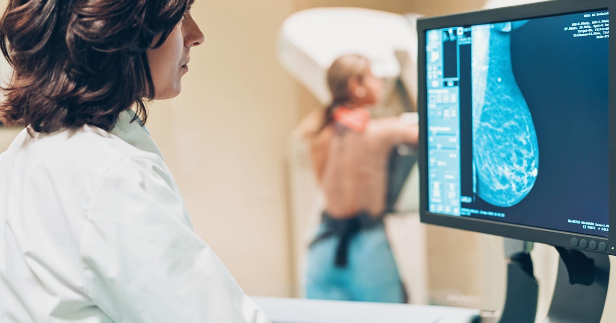 Breast cancer screenings are not only important for women but also men, advocates say