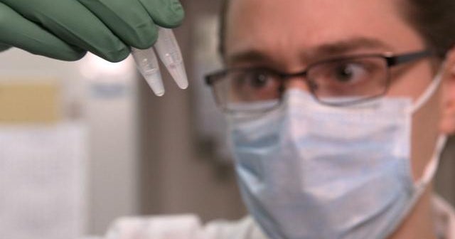 Could gene therapy cure sickle cell anemia? - CBS News