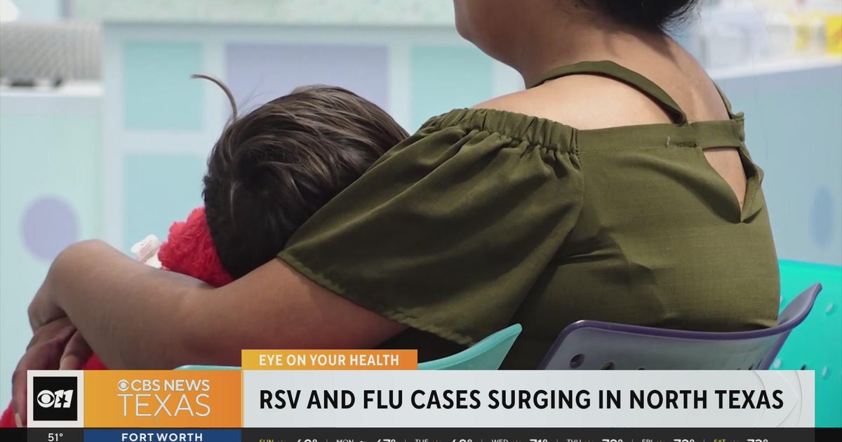 Flu, RSV cases surging in North Texas - CBS Texas