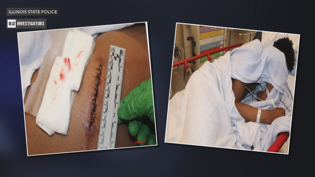 injury-gurness-2shot-2.png