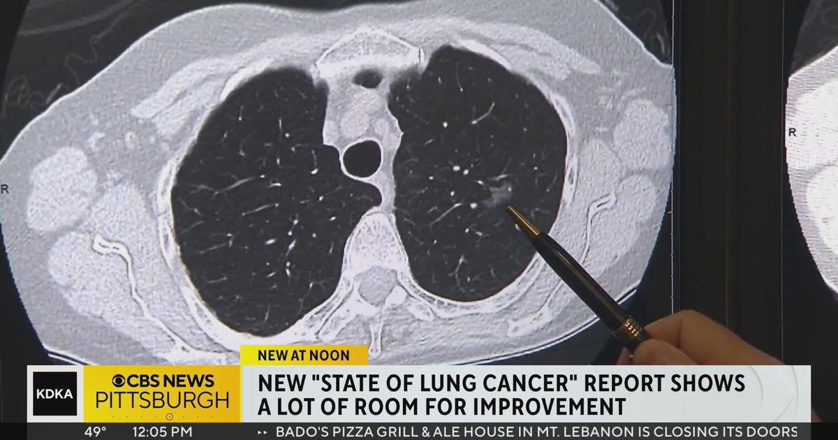 Lung cancer is still the leading cause of cancer deaths in Pennsylvania ...