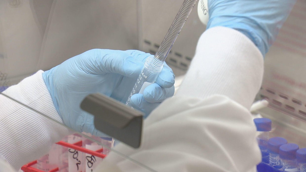 Denver Health study aimed at expanding genetic testing for cancer - CBS ...