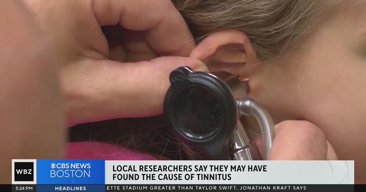 Tinnitus caused by auditory nerve damage, local researchers find CBS