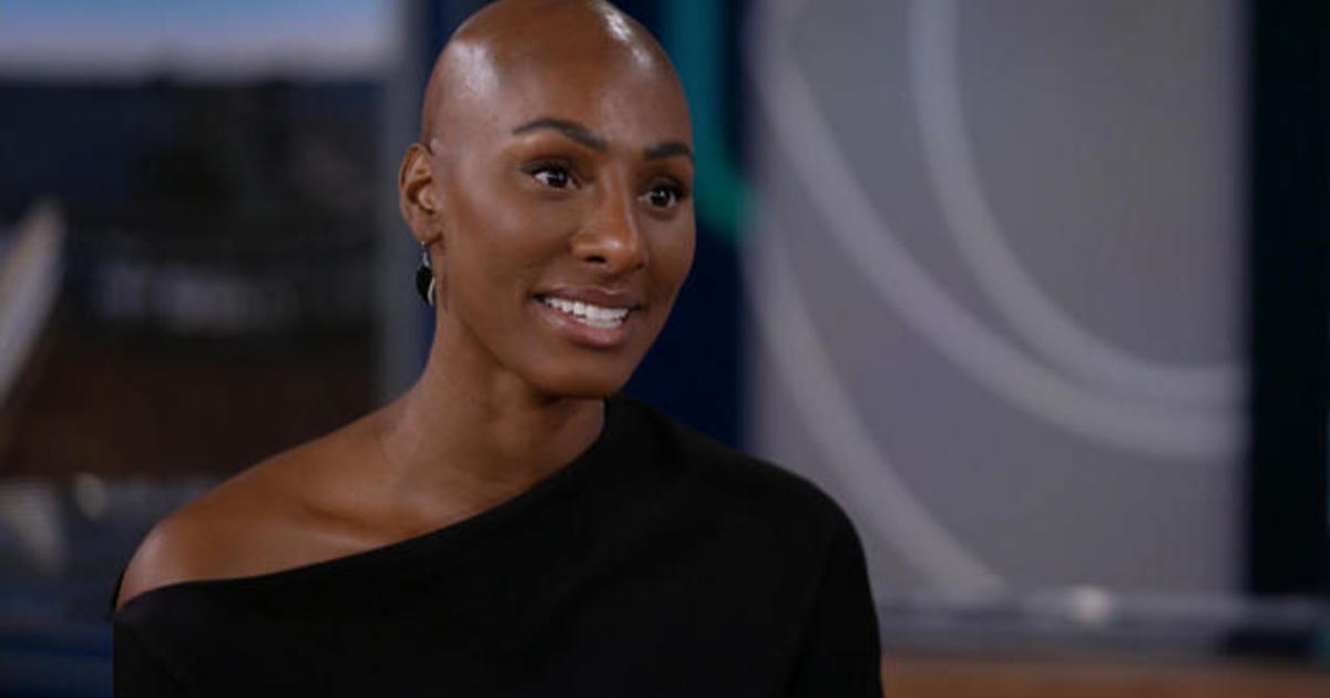 CBS News Philadelphia's Aziza Shuler shares her alopecia journey: "So much fear and anxiety about revealing this secret"