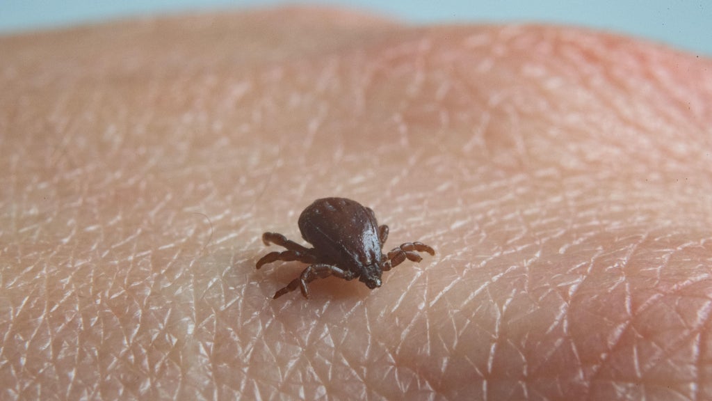 Ticks may be worse after the mild winter. Here's what you need to know about tick-borne disease.