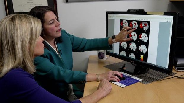 brain-scans.jpg