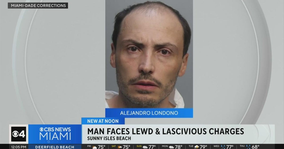Gentleman accused of exposing himself to woman at resort in Sunny Isles Seaside