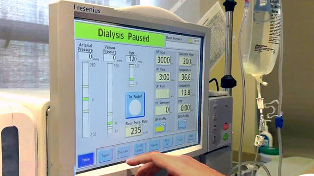 dialysis-machine-122123.jpg 