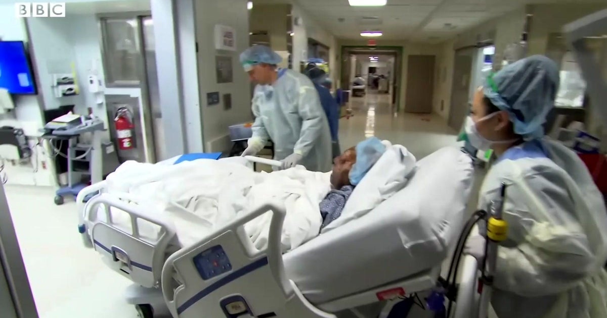 Initially Black affected individual to receive face transplant advocates for more donors, increase recognition Initially Black affected individual to receive face transplant advocates for more donors, increase recognition