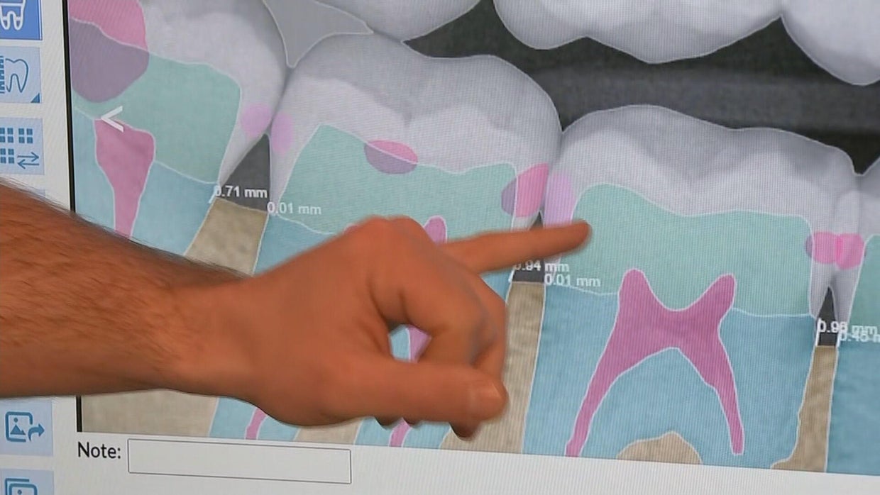 Delaware dentist uses artificial intelligence to accurately assess ...