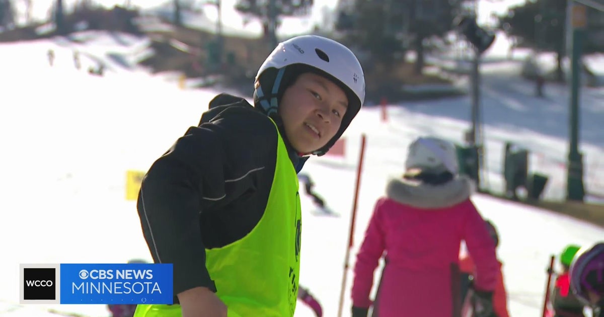 Shriners Children's patients hit the slopes CBS Minnesota