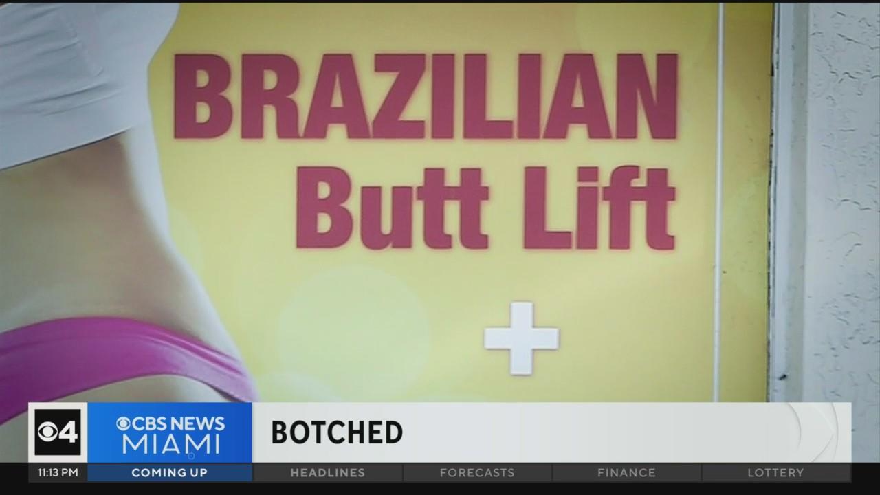 BBL Miami, Plastic Surgery, Brazilian Butt Lift