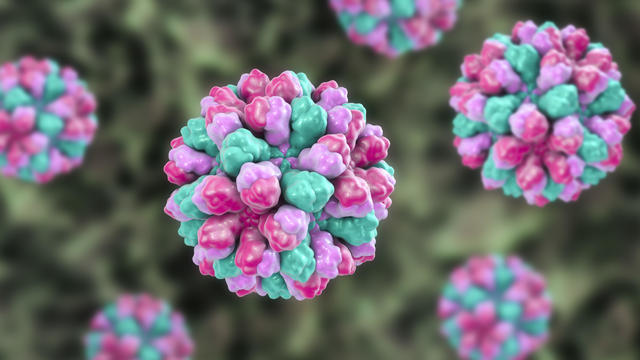 Norovirus, illustration 