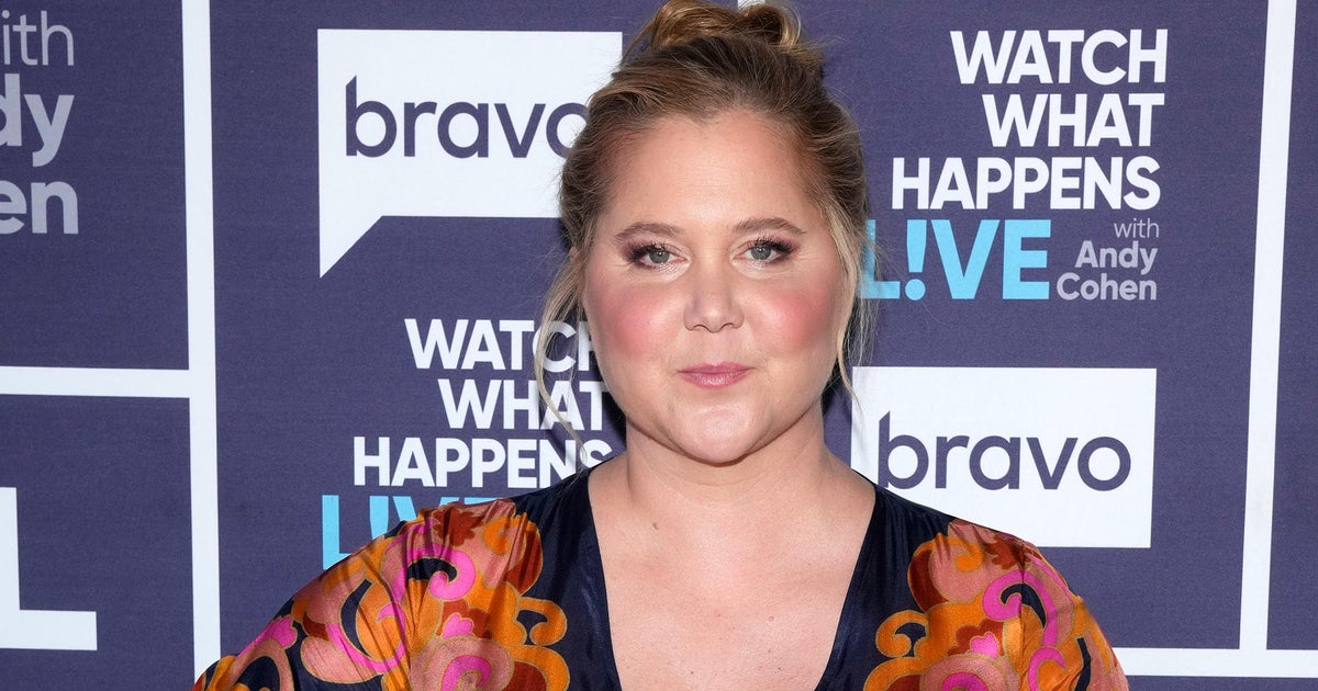 Amy Schumer says criticism of her rounder face led to diagnosis of Cushing syndrome Amy Schumer says criticism of her rounder face led to diagnosis of Cushing syndrome